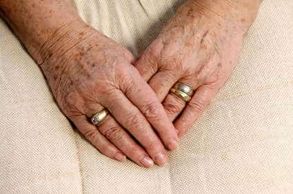 Frauenhände mit Altersflecken